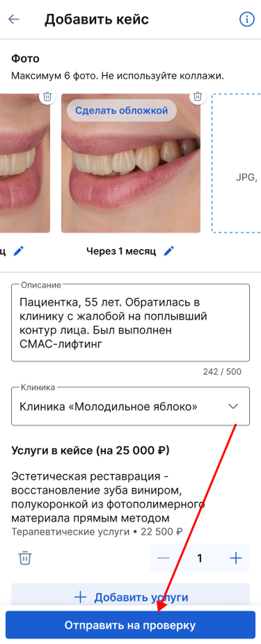 Frame 451427376